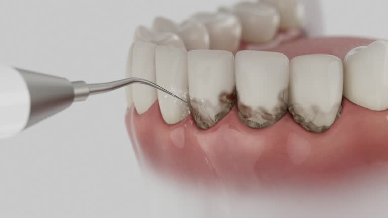 Reliable Dental contractor in Candlewick Lake, IL by Dentist Open Now